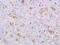 Albumin antibody, GTX60252, GeneTex, Immunohistochemistry paraffin image 