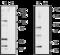 Transient Receptor Potential Cation Channel Subfamily V Member 2 antibody, GTX16610, GeneTex, Western Blot image 