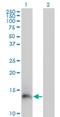 Peptidase Inhibitor 3 antibody, H00005266-M02, Novus Biologicals, Western Blot image 