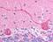 Checkpoint with forkhead and RING finger domains protein antibody, NB100-1166, Novus Biologicals, Immunohistochemistry paraffin image 