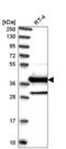 DnaJ Heat Shock Protein Family (Hsp40) Member C22 antibody, NBP2-58463, Novus Biologicals, Western Blot image 