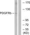 Platelet Derived Growth Factor Receptor Beta antibody, LS-C118222, Lifespan Biosciences, Western Blot image 