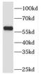 TBC1 Domain Family Member 22A antibody, FNab08512, FineTest, Western Blot image 