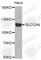 Solute Carrier Family 12 Member 4 antibody, A4116, ABclonal Technology, Western Blot image 