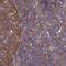 NME2 antibody, NBP2-13662, Novus Biologicals, Immunohistochemistry paraffin image 