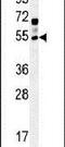 Gamma-Aminobutyric Acid Type A Receptor Gamma2 Subunit antibody, PA5-23698, Invitrogen Antibodies, Western Blot image 