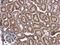Coiled-Coil-Helix-Coiled-Coil-Helix Domain Containing 3 antibody, NBP2-21606, Novus Biologicals, Immunohistochemistry paraffin image 