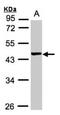 Vacuolar Protein Sorting 72 Homolog antibody, NBP1-32503, Novus Biologicals, Western Blot image 