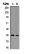 Troponin I3, Cardiac Type antibody, orb393178, Biorbyt, Western Blot image 
