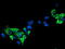 Sirtuin 5 antibody, M02395-1, Boster Biological Technology, Immunofluorescence image 
