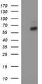 Interleukin 10 Receptor Subunit Alpha antibody, LS-C338273, Lifespan Biosciences, Western Blot image 