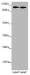 Hexokinase 3 antibody, LS-C675866, Lifespan Biosciences, Western Blot image 