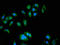 ATPase H+ Transporting V0 Subunit A1 antibody, LS-C672035, Lifespan Biosciences, Immunofluorescence image 