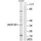 Aldose reductase antibody, PA5-49974, Invitrogen Antibodies, Western Blot image 