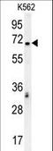Transcription Factor 4 antibody, LS-C161772, Lifespan Biosciences, Western Blot image 