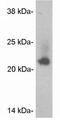 Caveolin 2 antibody, GTX22911, GeneTex, Western Blot image 