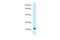 RAS Like Family 11 Member B antibody, A14188, Boster Biological Technology, Western Blot image 