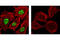 Nuclear Receptor Coactivator 3 antibody, 2979S, Cell Signaling Technology, Immunofluorescence image 