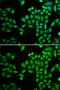 Protein Tyrosine Phosphatase Non-Receptor Type 1 antibody, GTX55767, GeneTex, Immunofluorescence image 