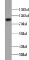 Tgr antibody, FNab09135, FineTest, Western Blot image 