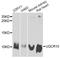 Ubiquinol-Cytochrome C Reductase, Complex III Subunit X antibody, A12587, ABclonal Technology, Western Blot image 