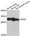 Docking Protein 5 antibody, A11431, Boster Biological Technology, Western Blot image 