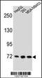 Zinc Finger Protein 860 antibody, 56-022, ProSci, Western Blot image 