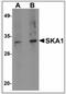 Spindle And Kinetochore Associated Complex Subunit 1 antibody, NBP1-72131, Novus Biologicals, Western Blot image 