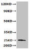 Transmembrane P24 Trafficking Protein 3 antibody, CSB-PA897107LA01HU, Cusabio, Western Blot image 