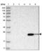 Abhydrolase Domain Containing 14B antibody, NBP1-84472, Novus Biologicals, Western Blot image 