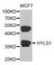 HYLS1 Centriolar And Ciliogenesis Associated antibody, A13703, Boster Biological Technology, Western Blot image 