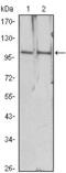 Histone Deacetylase 4 antibody, GTX83229, GeneTex, Western Blot image 