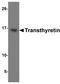 Transthyretin antibody, NBP2-41101, Novus Biologicals, Western Blot image 