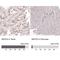 SET And MYND Domain Containing 2 antibody, NBP1-83186, Novus Biologicals, Immunohistochemistry paraffin image 