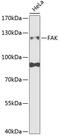 Protein Tyrosine Kinase 2 antibody, 18-512, ProSci, Western Blot image 