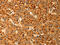 RB Binding Protein 9, Serine Hydrolase antibody, CSB-PA267054, Cusabio, Immunohistochemistry paraffin image 