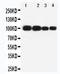 Myelin Associated Glycoprotein antibody, LS-C312897, Lifespan Biosciences, Western Blot image 