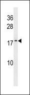 ATP Synthase Membrane Subunit G Like antibody, LS-C159139, Lifespan Biosciences, Western Blot image 