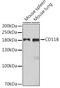 CD11b antibody, GTX32495, GeneTex, Western Blot image 