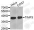 TIMP Metallopeptidase Inhibitor 3 antibody, A1511, ABclonal Technology, Western Blot image 