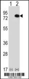 Serine/threonine-protein kinase RIO1 antibody, 62-724, ProSci, Western Blot image 