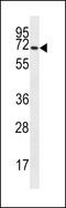 Solute Carrier Family 6 Member 14 antibody, LS-C161262, Lifespan Biosciences, Western Blot image 