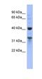 Mitochondrial Ribosomal Protein L37 antibody, orb326138, Biorbyt, Western Blot image 