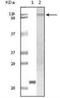 Tyrosine Kinase 2 antibody, NB110-89454, Novus Biologicals, Western Blot image 