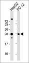 Poly(A) Binding Protein Cytoplasmic 5 antibody, orb374336, Biorbyt, Western Blot image 