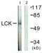 LCK Proto-Oncogene, Src Family Tyrosine Kinase antibody, LS-C117665, Lifespan Biosciences, Western Blot image 