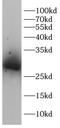 Glutamate-Cysteine Ligase Modifier Subunit antibody, FNab10249, FineTest, Western Blot image 