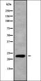 RAS Like Proto-Oncogene B antibody, orb338635, Biorbyt, Western Blot image 
