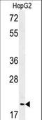 Geminin DNA Replication Inhibitor antibody, LS-C166536, Lifespan Biosciences, Western Blot image 