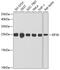 Eukaryotic Translation Initiation Factor 3 Subunit K antibody, 24-003, ProSci, Western Blot image 